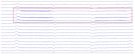 640?wx_fmt=png&tp=webp&wxfrom=5&wx_lazy=1&wx_co=1.jpg